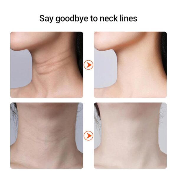 Skin Tightening, Anti-Wrinkle, 45°C Heat, 4 Modes, EMS Toning (White) - Image 4