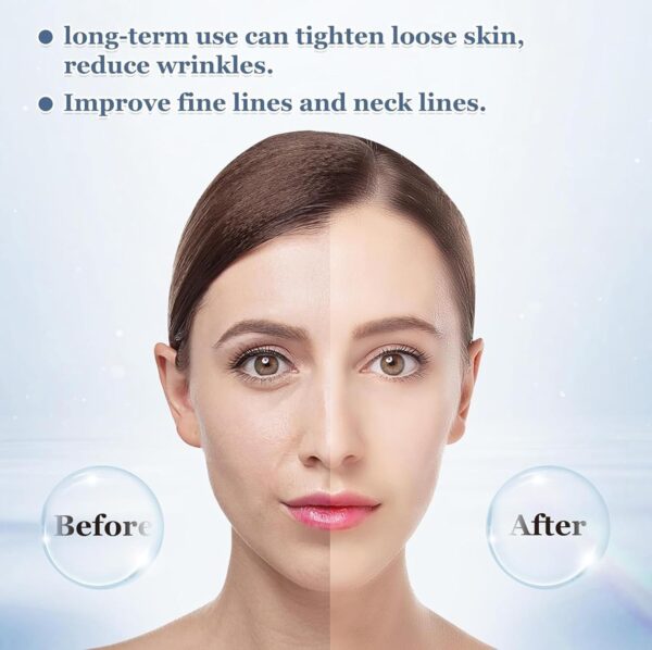 Skin Tightening, Anti-Wrinkle, 45°C Heat, 4 Modes, EMS Toning (White) - Image 2