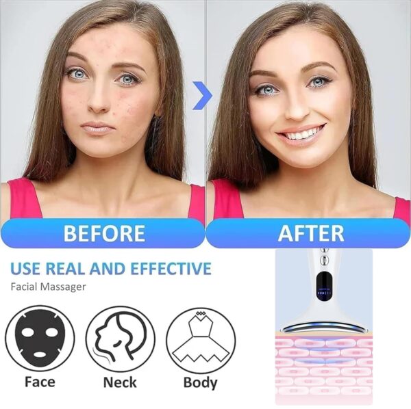 Skin Tightening, Anti-Wrinkle, 45°C Heat, 4 Modes, EMS Toning (White) - Image 7